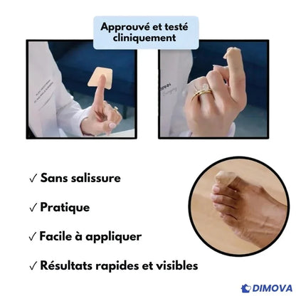Pansements antimycosiques pour la nuit (Boîte de 60 pansements)