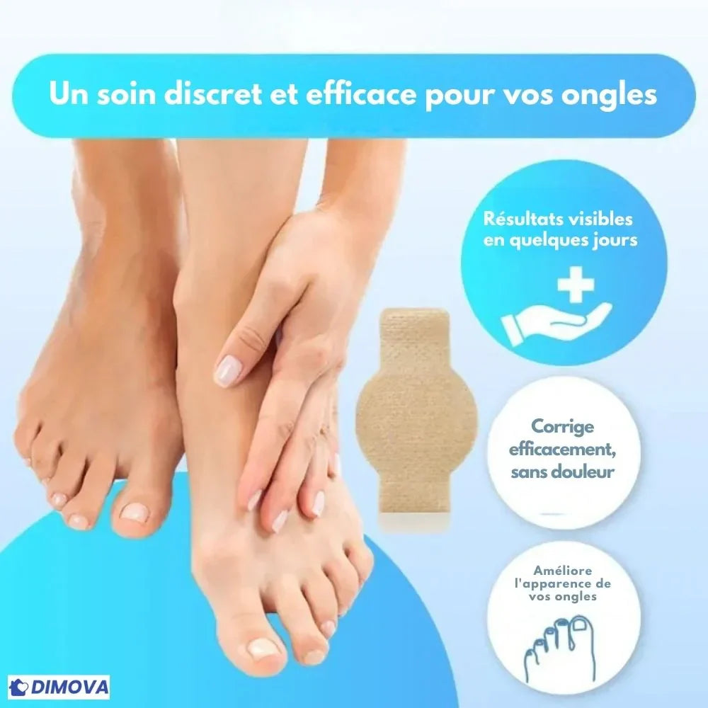 DIMOVA® – Patchs anti-mycoses efficaces et discrets