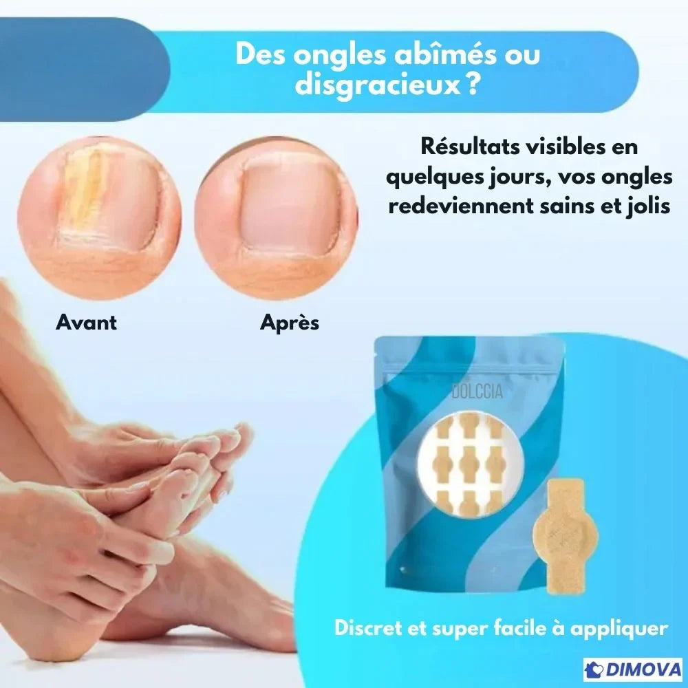 DIMOVA® – Patchs anti-mycoses efficaces et discrets