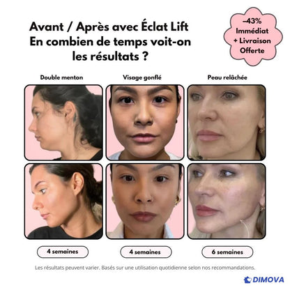 Éclat Lift - Rajeunit visiblement la peau en 30 jours