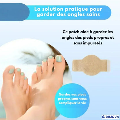 DIMOVA® – Patchs anti-mycoses efficaces et discrets