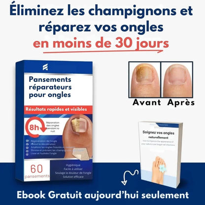 Pansements antimycosiques pour la nuit (Boîte de 60 pansements)